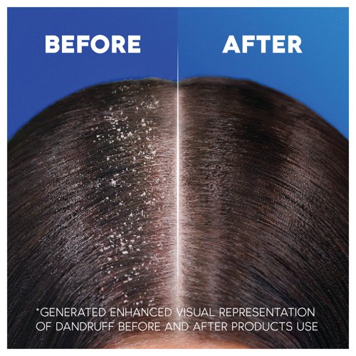Head And Shoulders Shampoo Smooth and Silky 250ml (Pack of 6) 86902